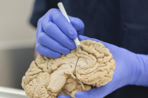 A human brain inside Liberty University's anatomical science lab.